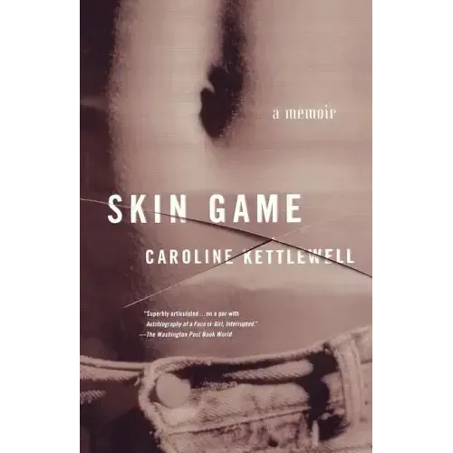 Skin Game: A Memoir