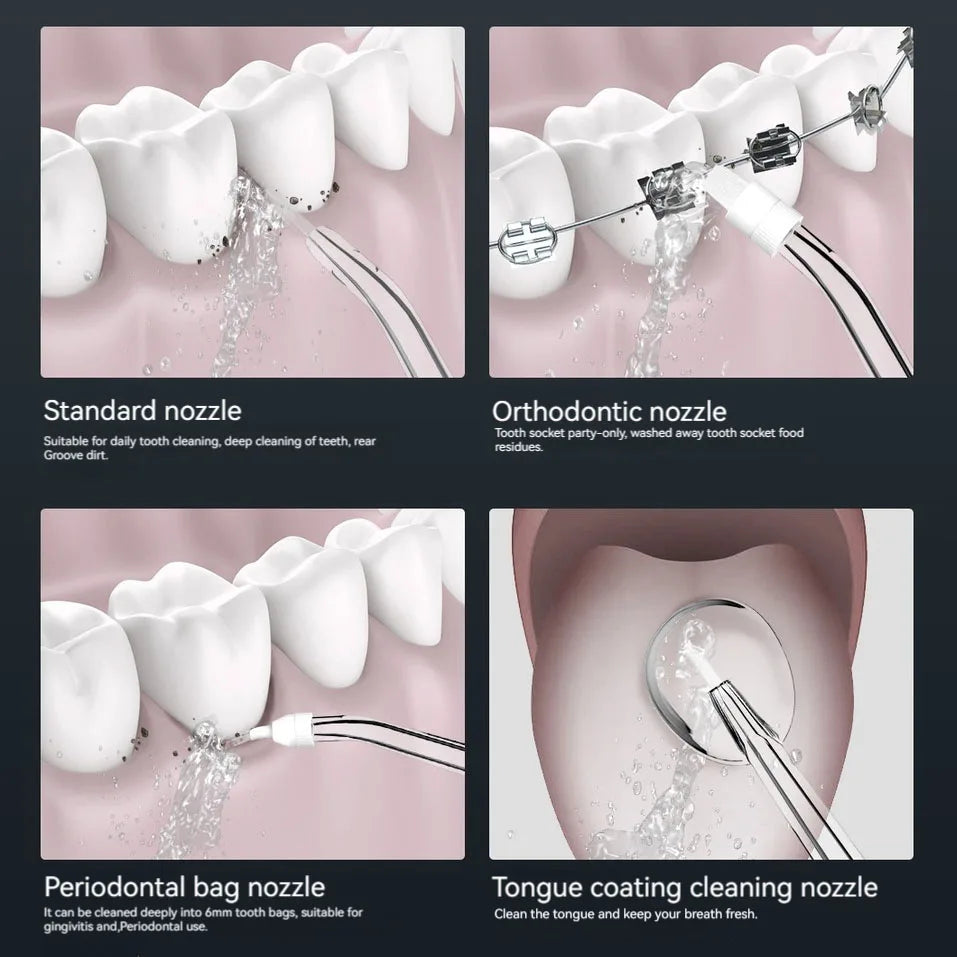 Household electric arterial irrigation device, convenient dental beauty device, water flosser, dental calculus irrigator, oral c
