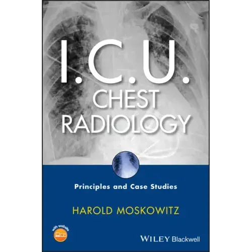 I.C.U. Chest Radiology: Principles and Case Studies [With CDROM]